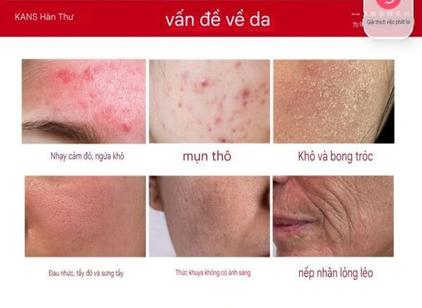 Bộ Dưỡng Da Phục Hồi Tái Tạo Cho Da Nhạy Cảm - Ảnh 6