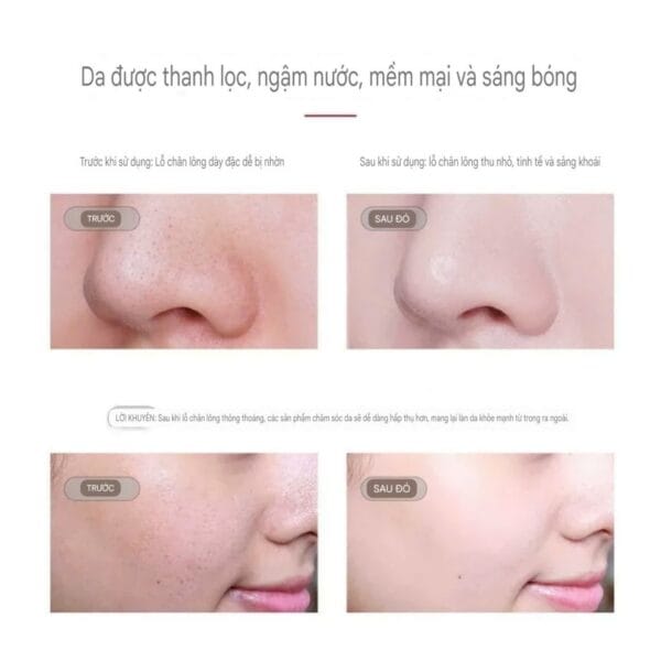 Tẩy Tế Bào Chết Làm Sáng Mịn Da Kans Đỏ - Hình ảnh 4