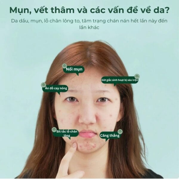 Sữa Rửa Mặt Kiềm Dầu Trị Mụn KANS Xanh - Hình ảnh 4